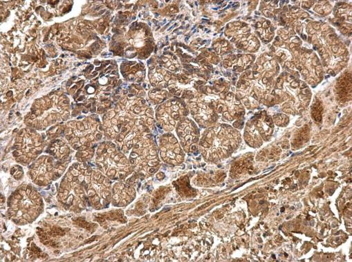 CDH4 Antibody in Immunohistochemistry (Paraffin) (IHC (P))
