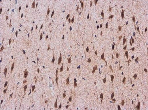 CDK5 Antibody in Immunohistochemistry (Paraffin) (IHC (P))