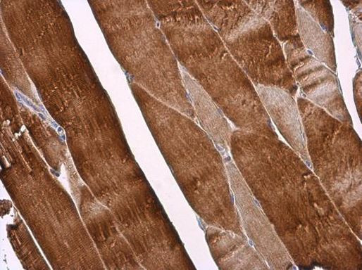 CDKN2C Antibody in Immunohistochemistry (Paraffin) (IHC (P))