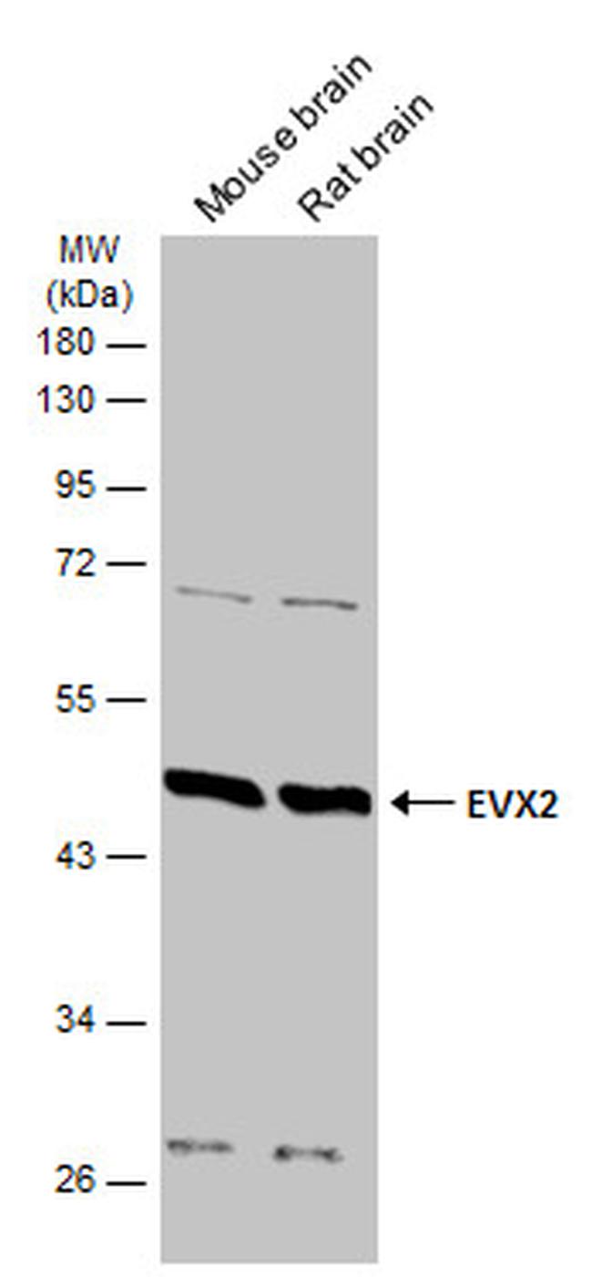 EVX2 Antibody in Western Blot (WB)