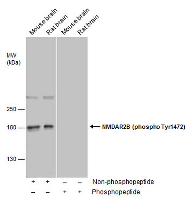 Phospho-NMDAR2B (Tyr1472) Antibody in Western Blot (WB)