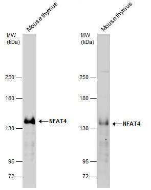 NFATC3 Antibody in Western Blot (WB)