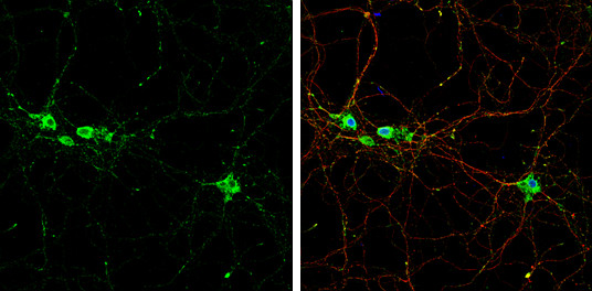 TrkB Antibody in Immunocytochemistry (ICC/IF)