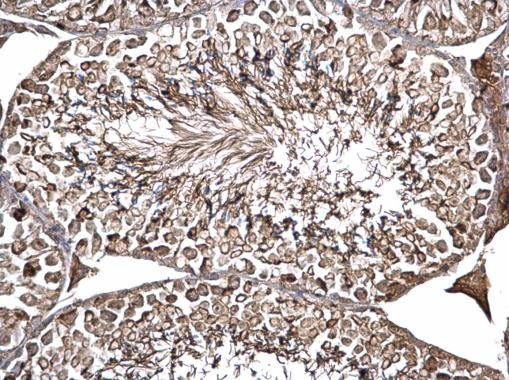 ODF2 Antibody in Immunohistochemistry (Paraffin) (IHC (P))