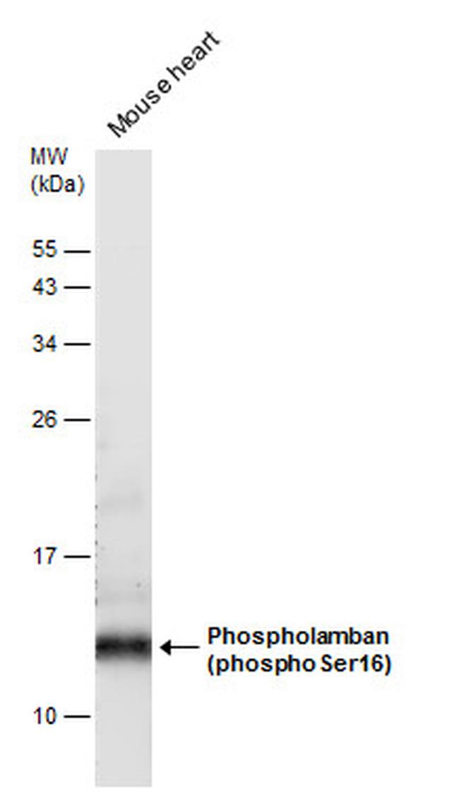 Phospho-Phospholamban (Ser16) Antibody in Western Blot (WB)