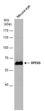 RPE65 Antibody in Western Blot (WB)