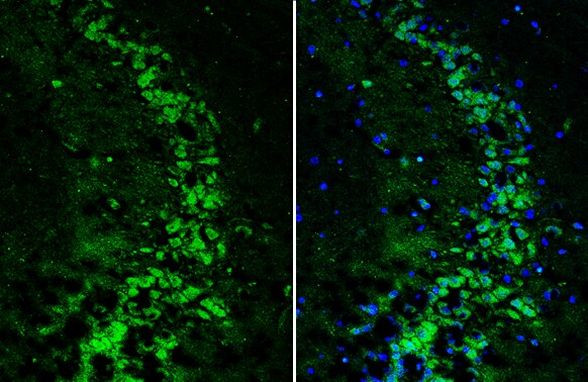 SH3GL1 Antibody in Immunohistochemistry (Frozen) (IHC (F))