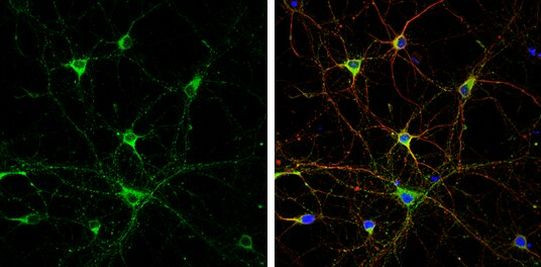SH3GL1 Antibody in Immunocytochemistry (ICC/IF)