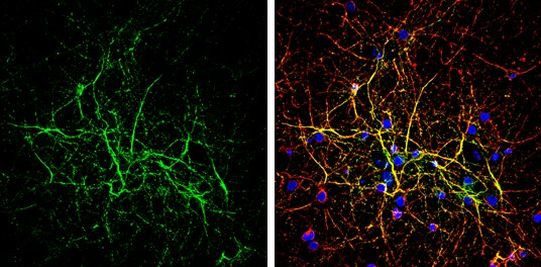 TIMP3 Antibody in Immunocytochemistry (ICC/IF)