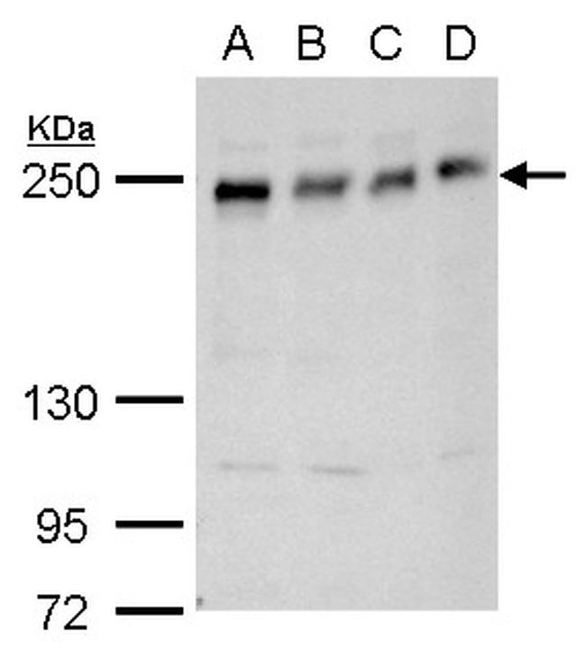ANKRD26 Antibody in Western Blot (WB)