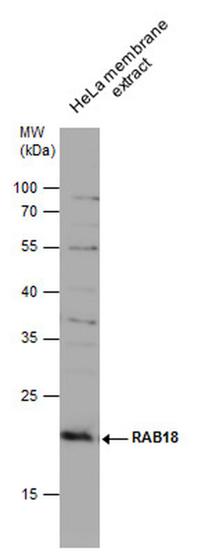 RAB18 Antibody in Western Blot (WB)