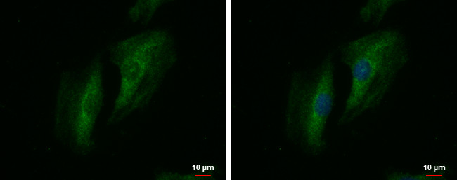 SWAP70 Antibody in Immunocytochemistry (ICC/IF)