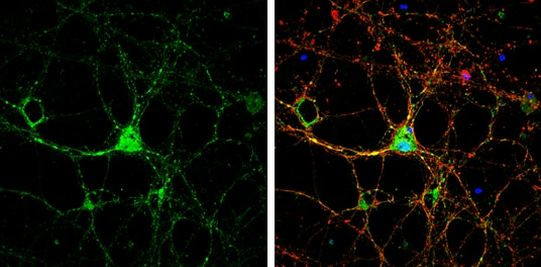 SARM Antibody in Immunocytochemistry (ICC/IF)