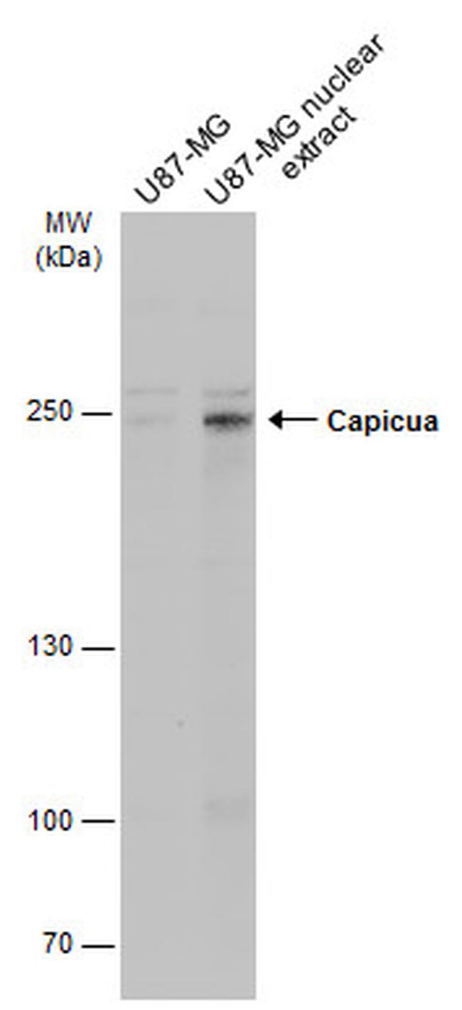 CIC Antibody in Western Blot (WB)