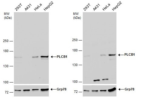 PLCB1 Antibody in Western Blot (WB)