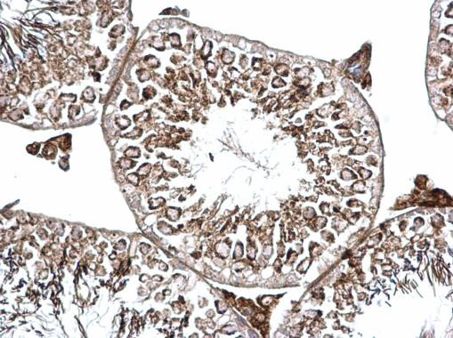 BICD2 Antibody in Immunohistochemistry (Paraffin) (IHC (P))