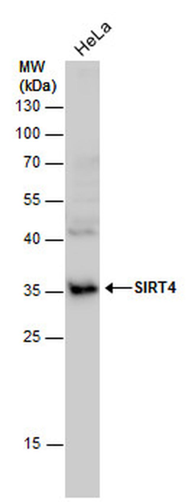 SIRT4 Antibody in Western Blot (WB)