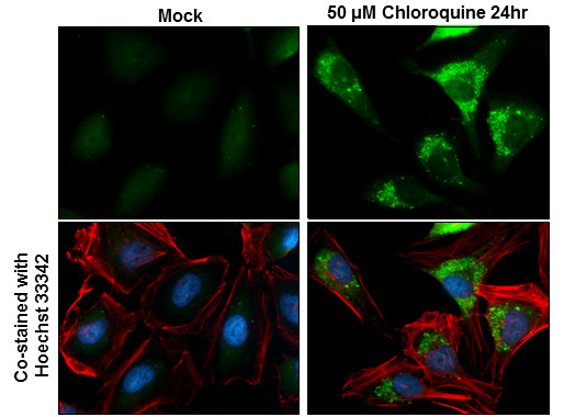 GABARAPL1 Antibody in Immunocytochemistry (ICC/IF)