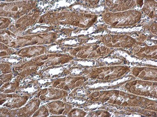 MTCH2 Antibody in Immunohistochemistry (Paraffin) (IHC (P))