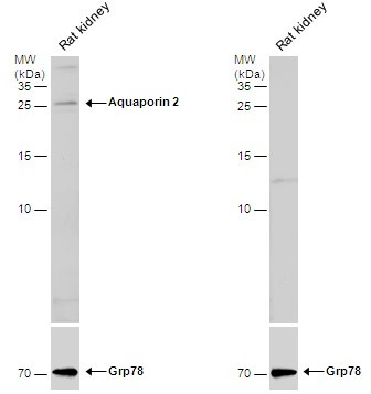 Aquaporin 2 Antibody in Western Blot (WB)