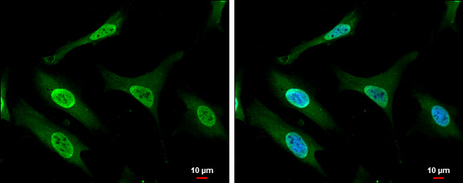 Gemin 5 Antibody in Immunocytochemistry (ICC/IF)