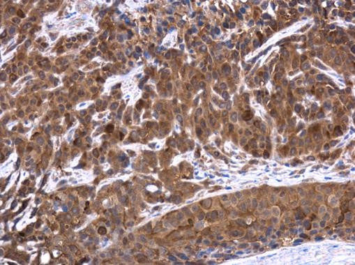 TES Antibody in Immunohistochemistry (Paraffin) (IHC (P))
