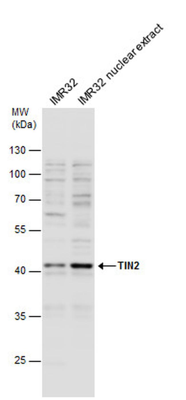 TIN2 Antibody in Western Blot (WB)