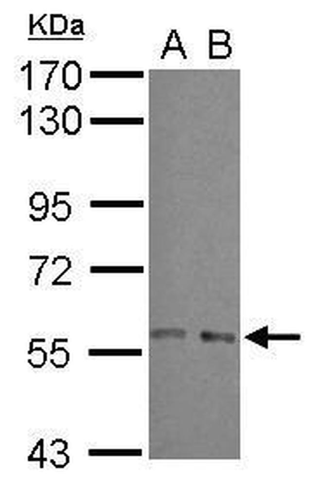 ARFGAP3 Antibody in Western Blot (WB)