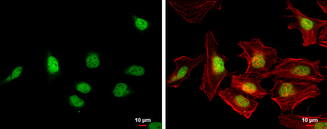 BRD7 Antibody in Immunocytochemistry (ICC/IF)