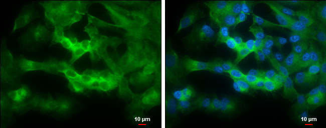 STRN4 Antibody in Immunocytochemistry (ICC/IF)
