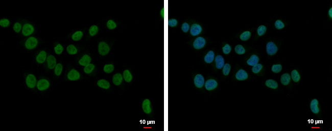 NIP7 Antibody in Immunocytochemistry (ICC/IF)