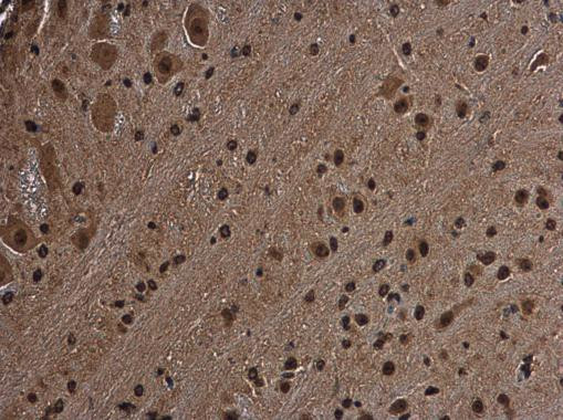 RGS14 Antibody in Immunohistochemistry (Paraffin) (IHC (P))
