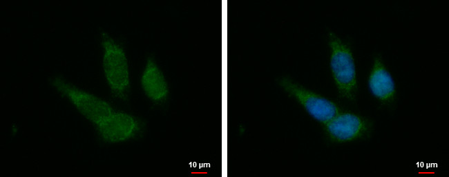 PTOV1 Antibody in Immunocytochemistry (ICC/IF)