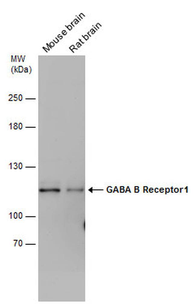 GABBR1 Antibody in Western Blot (WB)
