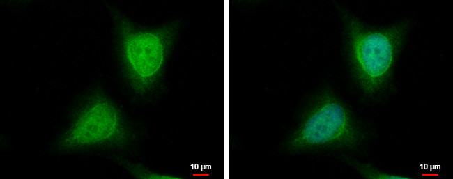 WDYHV1 Antibody in Immunocytochemistry (ICC/IF)