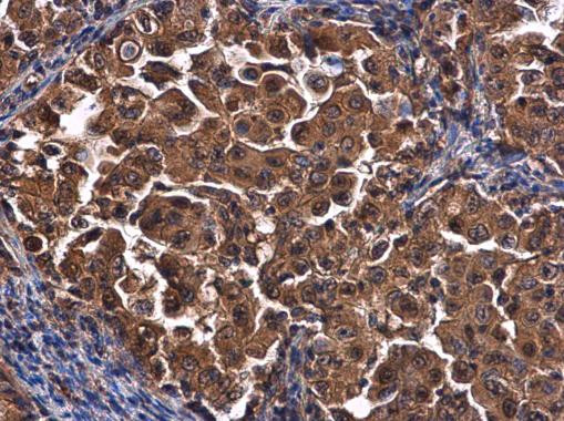 CEP192 Antibody in Immunohistochemistry (Paraffin) (IHC (P))