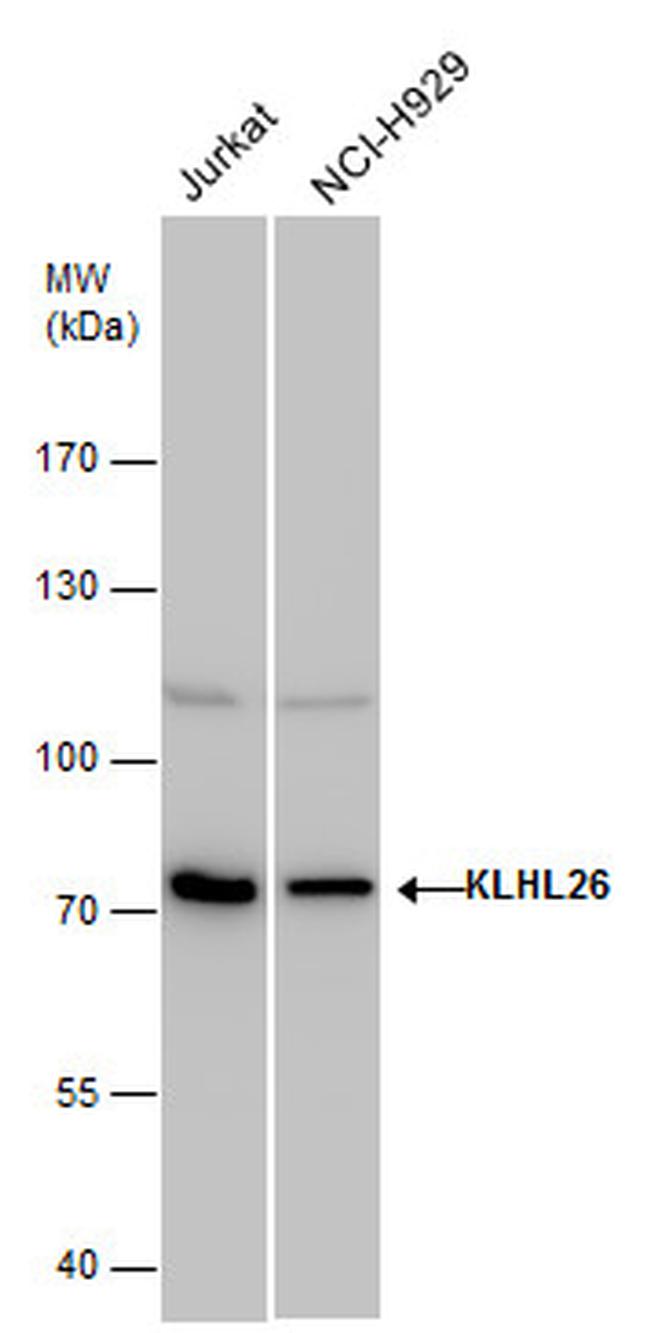 KLHL26 Antibody in Western Blot (WB)