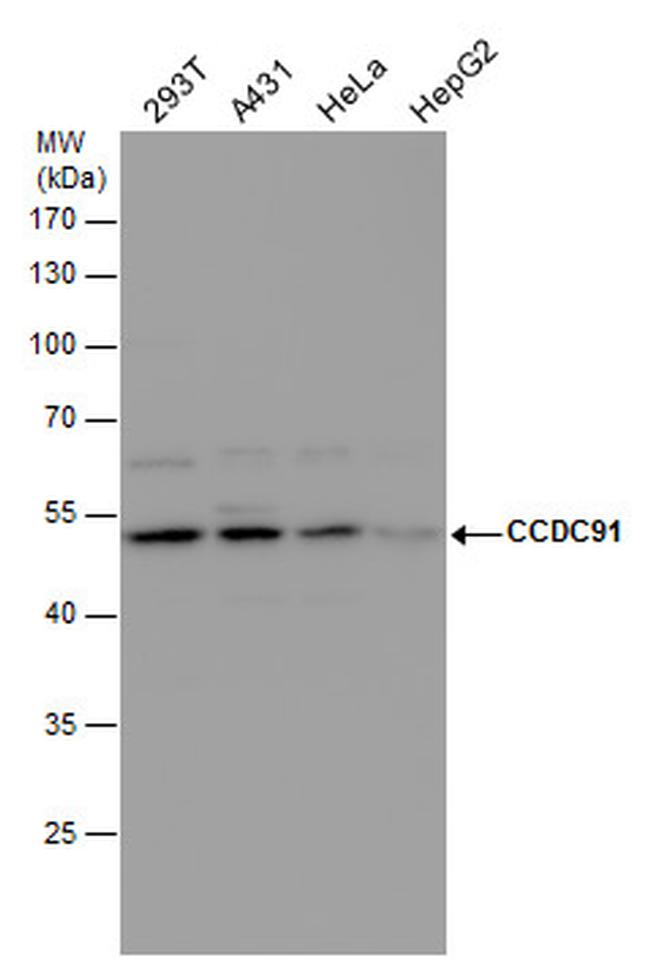 CCDC91 Antibody in Western Blot (WB)
