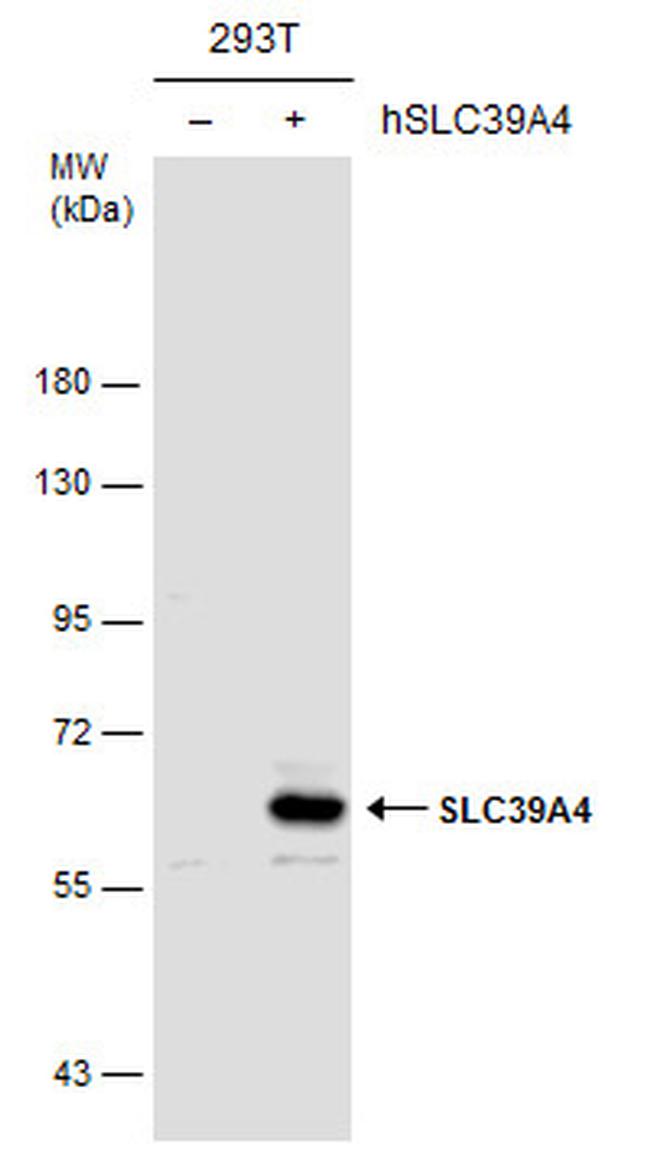 SLC39A4 Antibody in Western Blot (WB)
