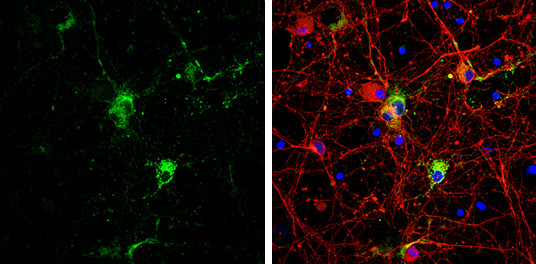 Syntabulin Antibody in Immunocytochemistry (ICC/IF)