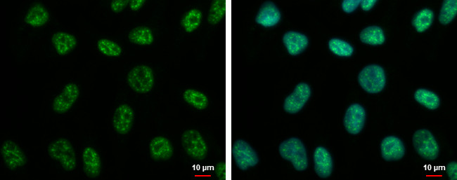 CHFR Antibody in Immunocytochemistry (ICC/IF)