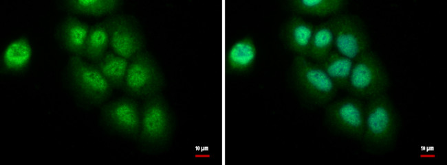CCAR1 Antibody in Immunocytochemistry (ICC/IF)