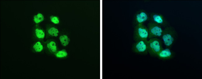 XPO5 Antibody in Immunocytochemistry (ICC/IF)