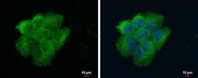 VPS18 Antibody in Immunocytochemistry (ICC/IF)