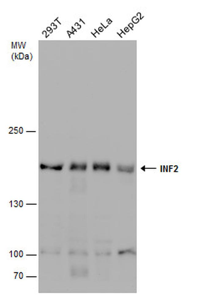 INF2 Antibody in Western Blot (WB)
