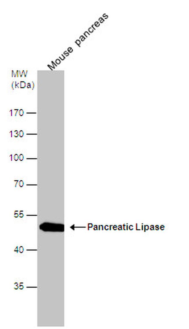 PNLIP Antibody in Western Blot (WB)