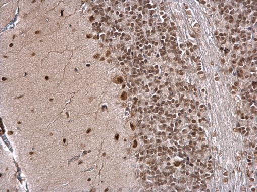 IPO5 Antibody in Immunohistochemistry (Paraffin) (IHC (P))