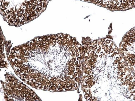 PAK4 Antibody in Immunohistochemistry (Paraffin) (IHC (P))