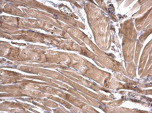 LRRFIP2 Antibody in Immunohistochemistry (Paraffin) (IHC (P))