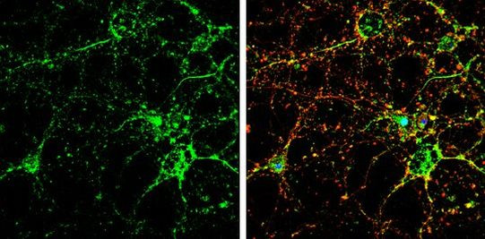 GRIP1 Antibody in Immunocytochemistry (ICC/IF)